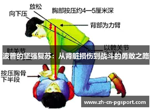 波普的坚强复苏：从肾脏损伤到战斗的勇敢之路